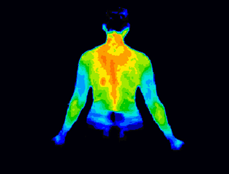 thermography and root canals